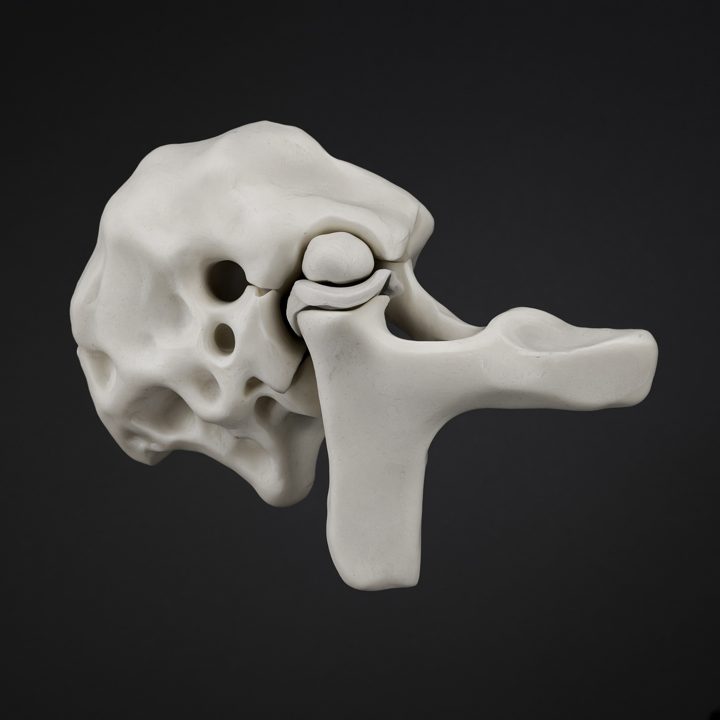 Modelo de la articulación temporomandibular